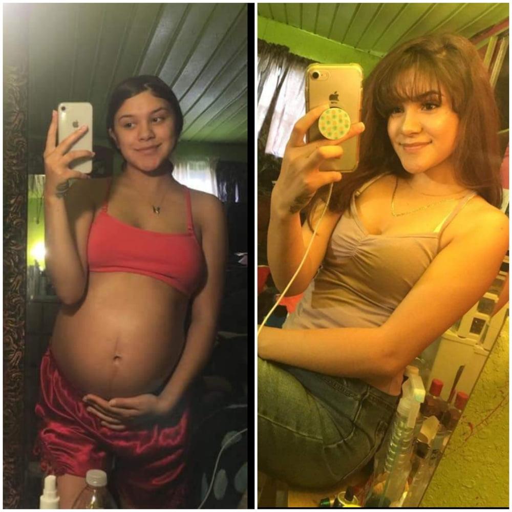 25P pregnant mix