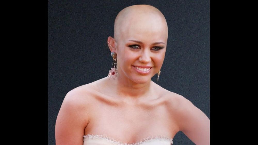 25P Celebrity bald fakes