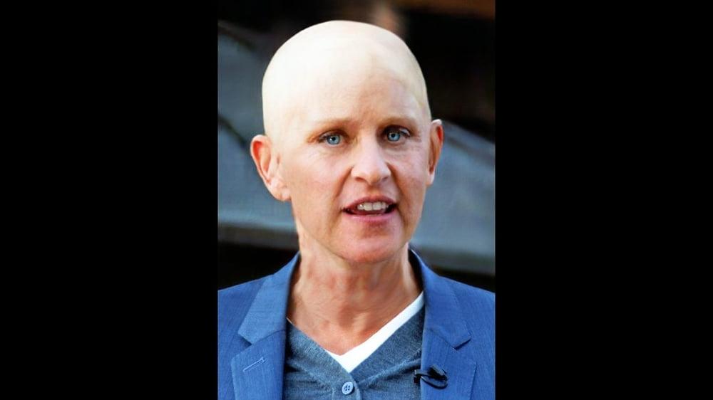 25P Celebrity bald fakes