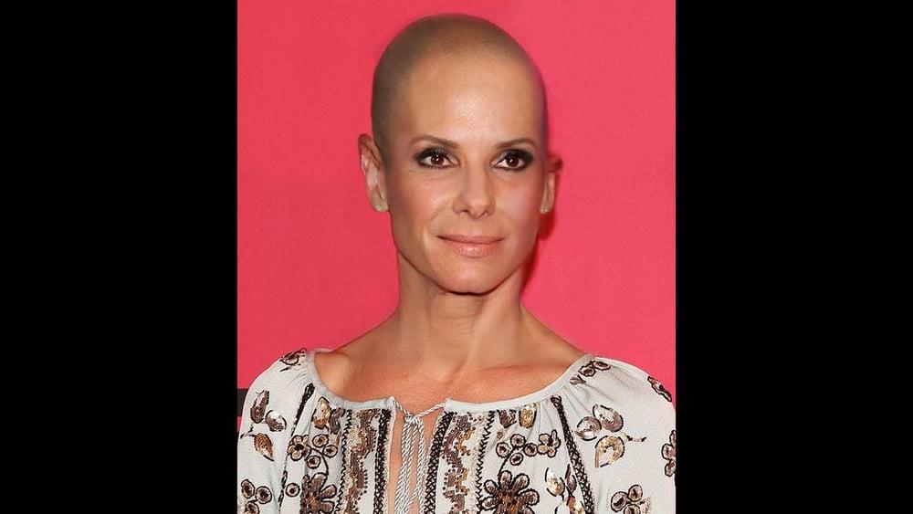25P Celebrity bald fakes