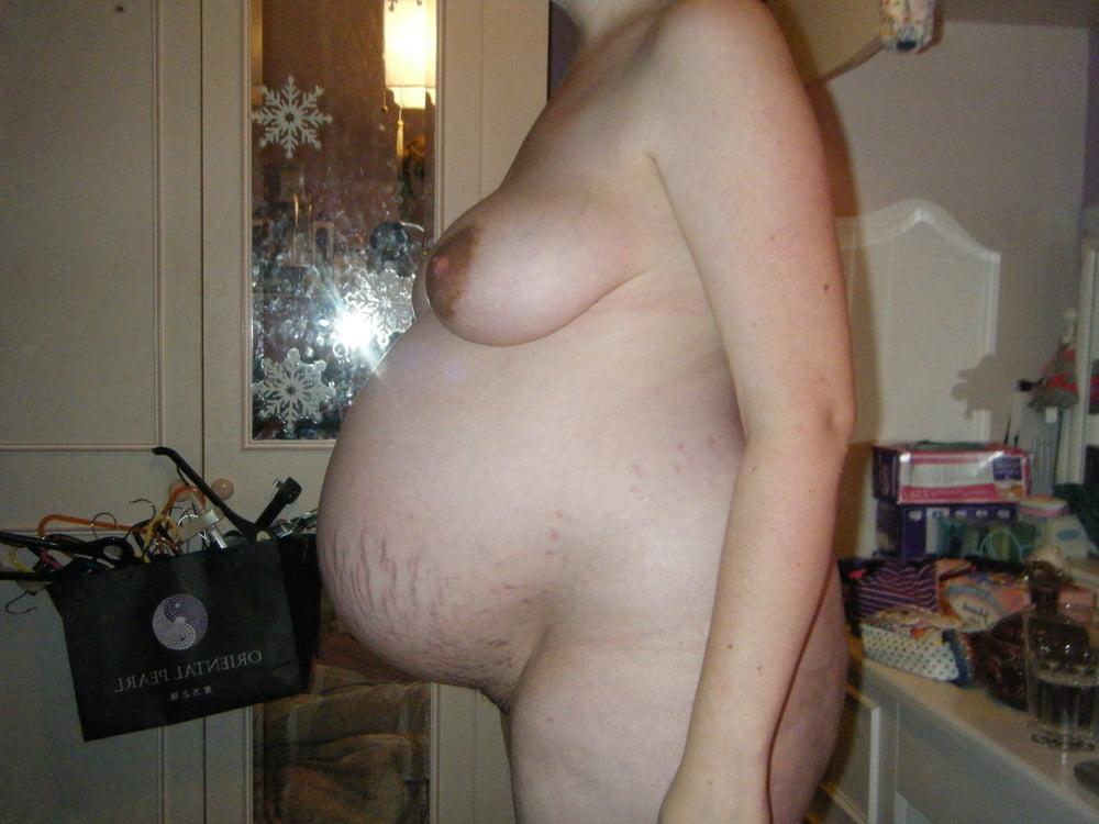 25P pregnant