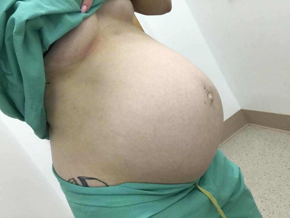 22P Pregnant 2