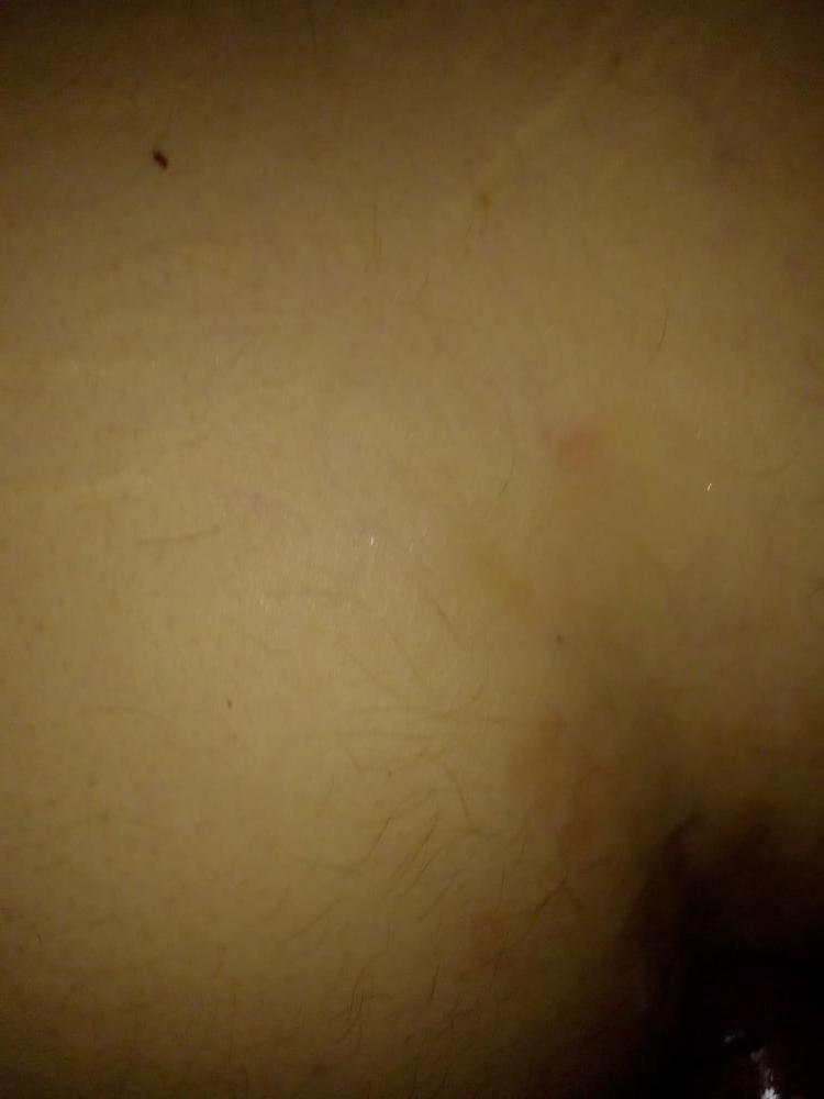 13P Ficktreff Erdbeermund Worms 25.06.2020