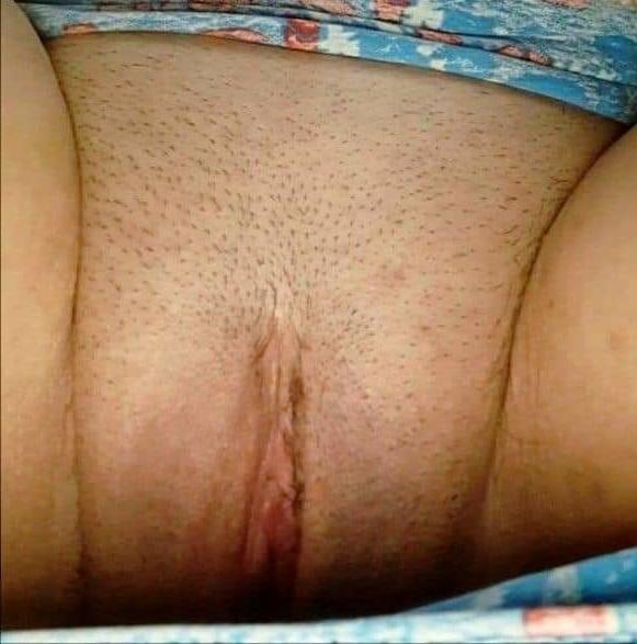 25P MI's Z