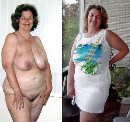 25P Dressed Undressed 30