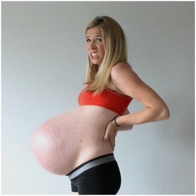 25P pregnant