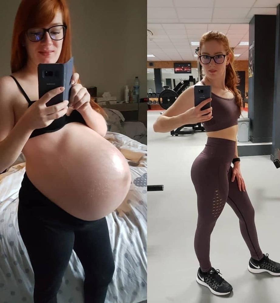 25P pregnant