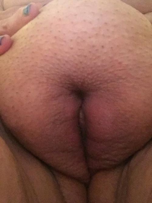 25P 244