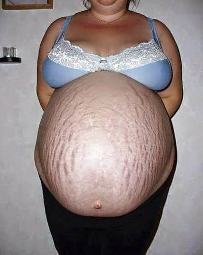 25P pregnant