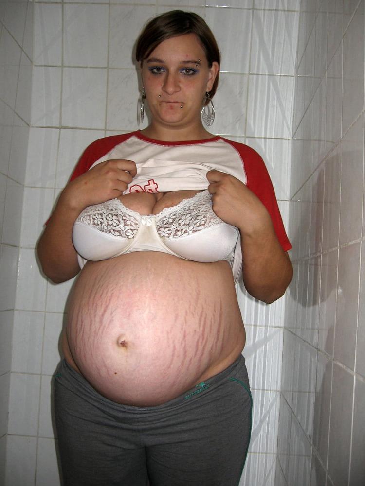 25P pregnant