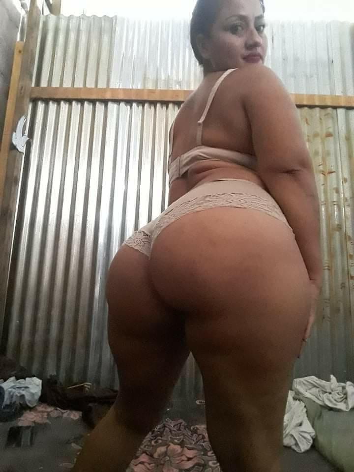 25P Surtido 2