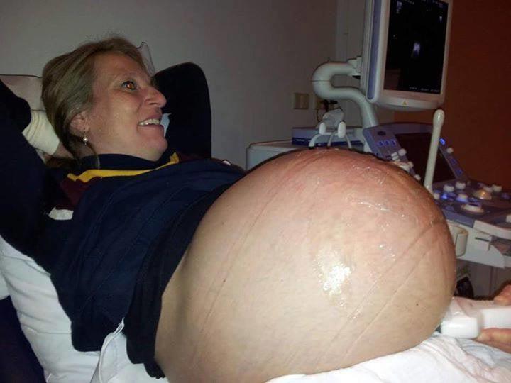 24P Pregnant 2