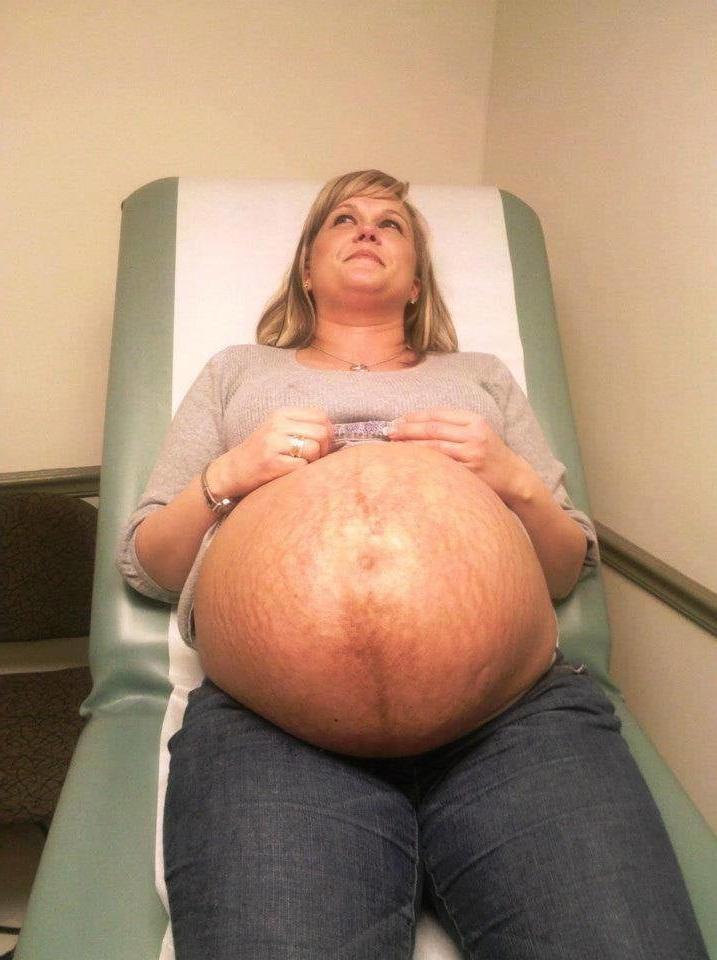 24P Pregnant 2