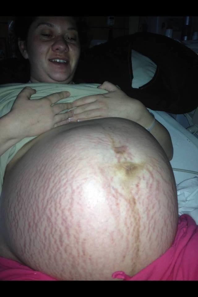 24P Pregnant 2