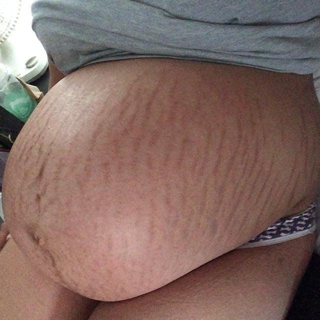 24P Pregnant 2