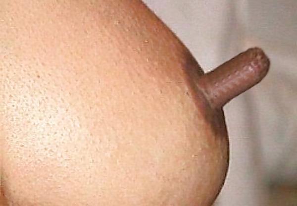 11P Nipples 