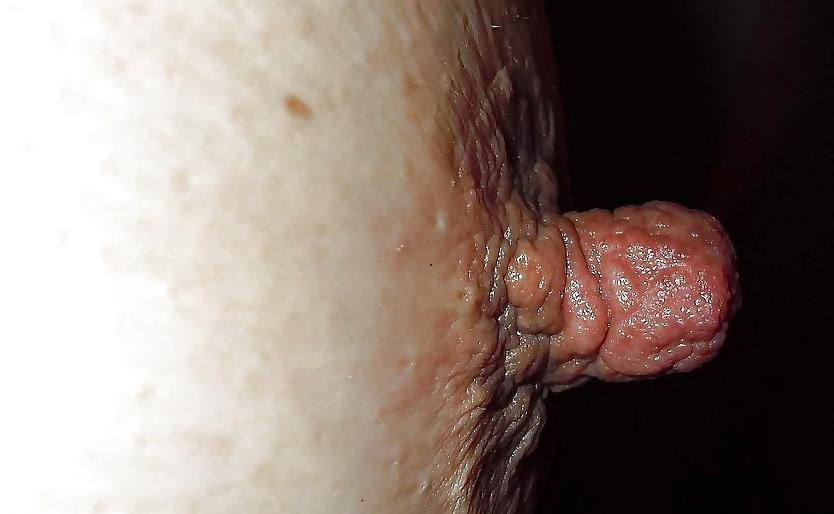 25P BIG Nipples