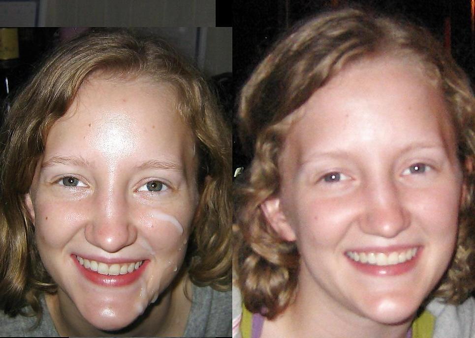 10P Before and after 2