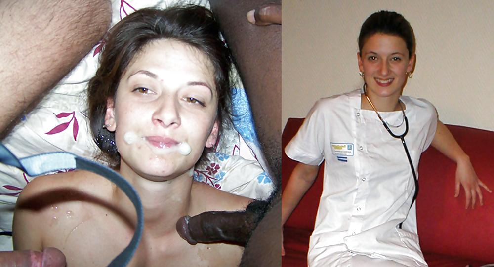 10P Before and after 2
