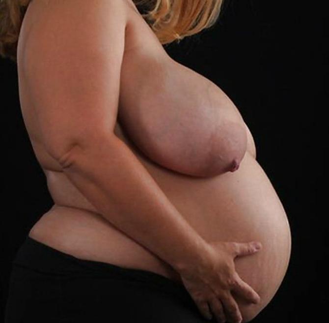 25P pregnant