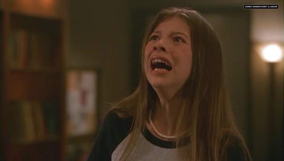 25P Trachtenberg - Open mouth wide