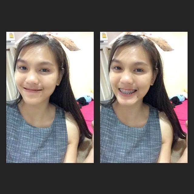 14P Thai Amateur-4