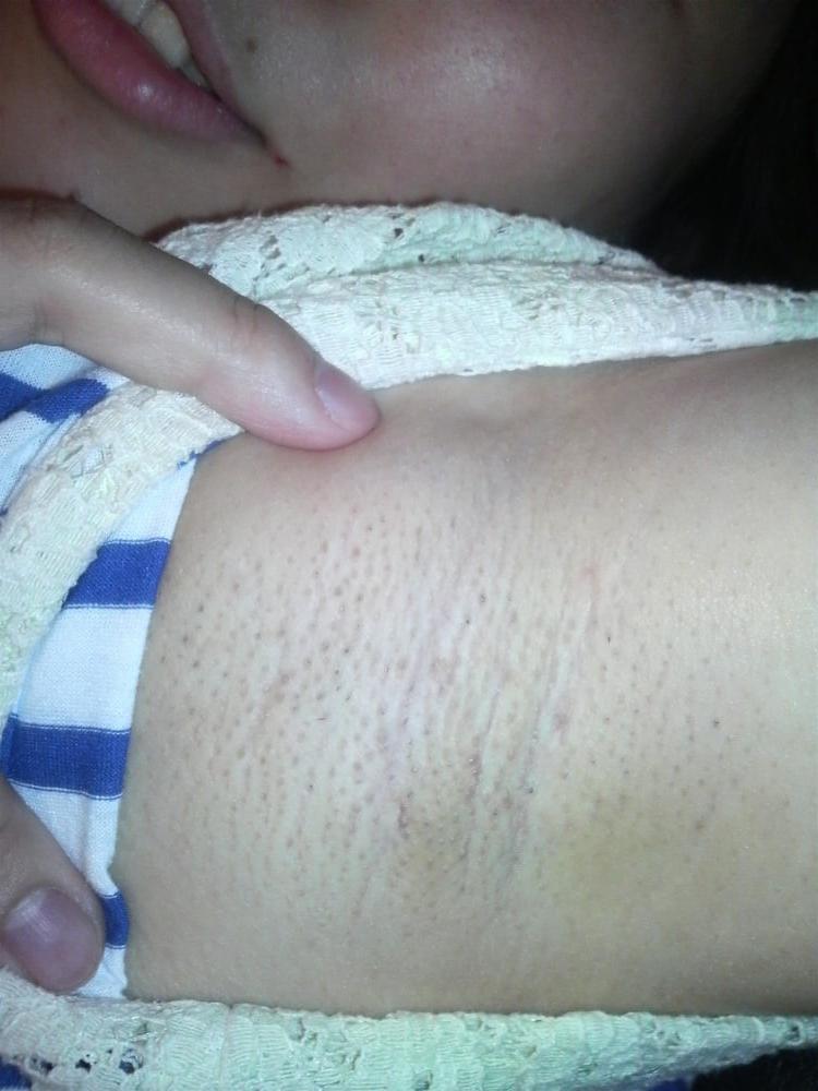 19P Japanese Amateur-6