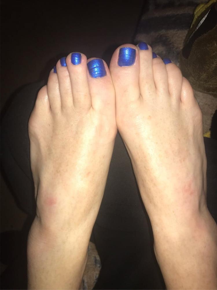 15P Pretty painted toes