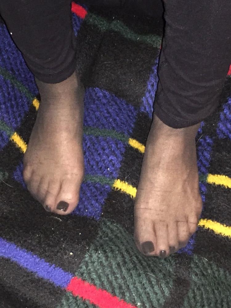 15P Pretty painted toes