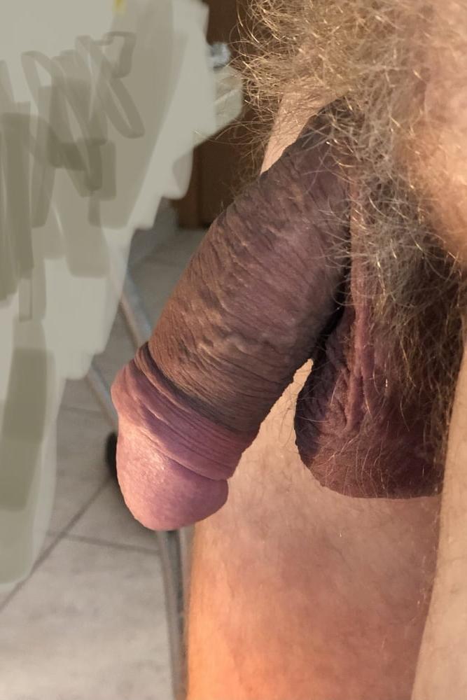 25P Beautiful thick dick. Hard-ons set 1
