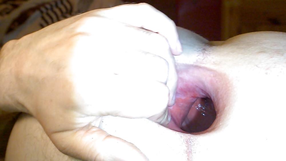 13P A big anal screw spreading my asshole to a giant gape part1