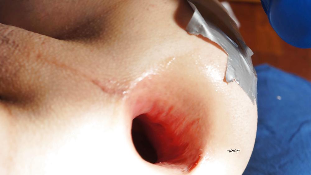16P My FAKE GAPE 17