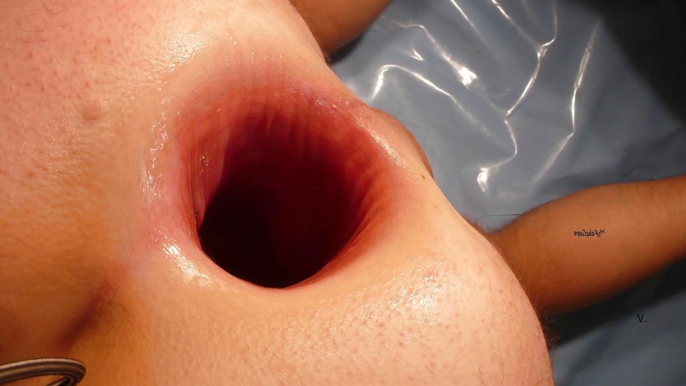 13P My FAKE GAPE 15