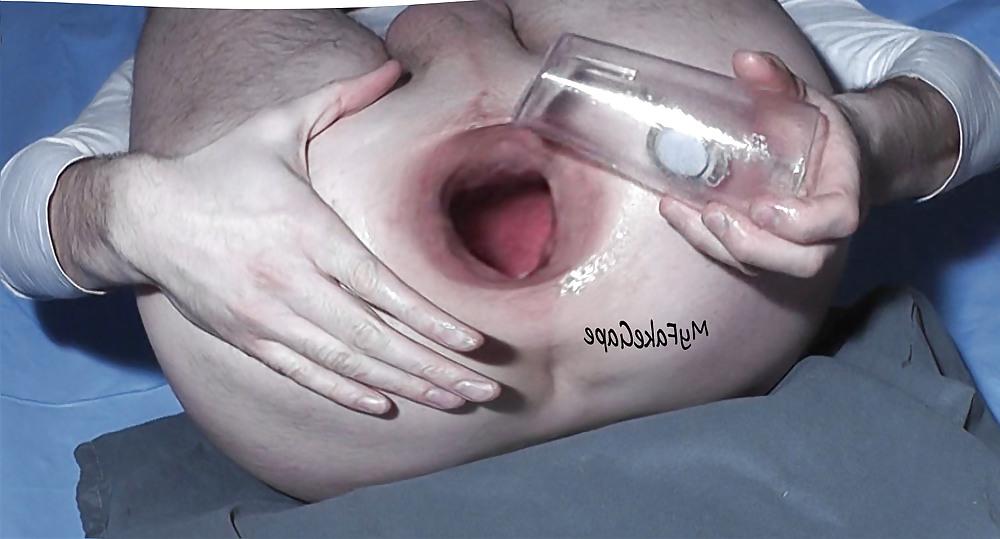 13P My FAKE Gape 5