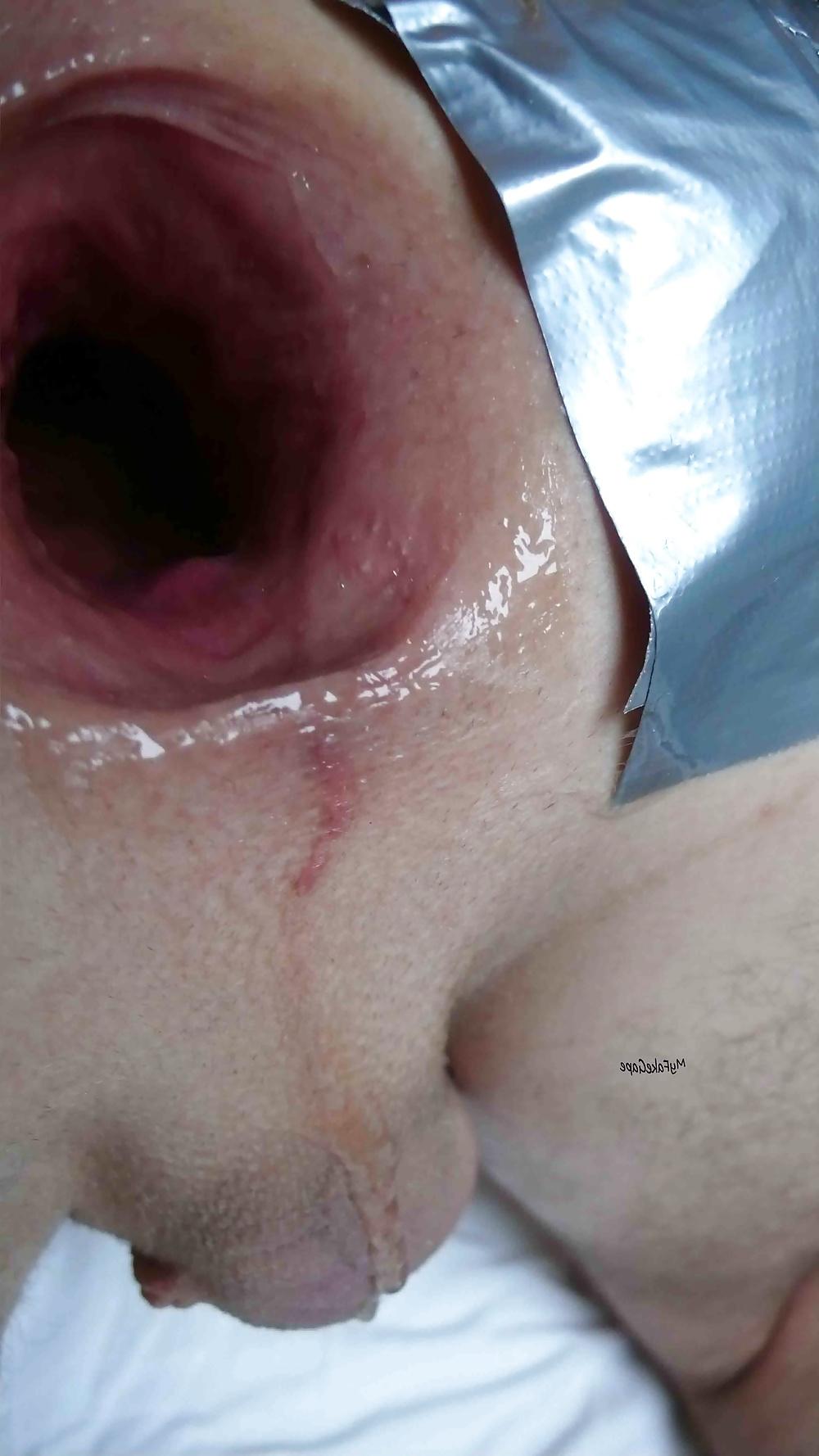 13P My FAKE GAPE 20