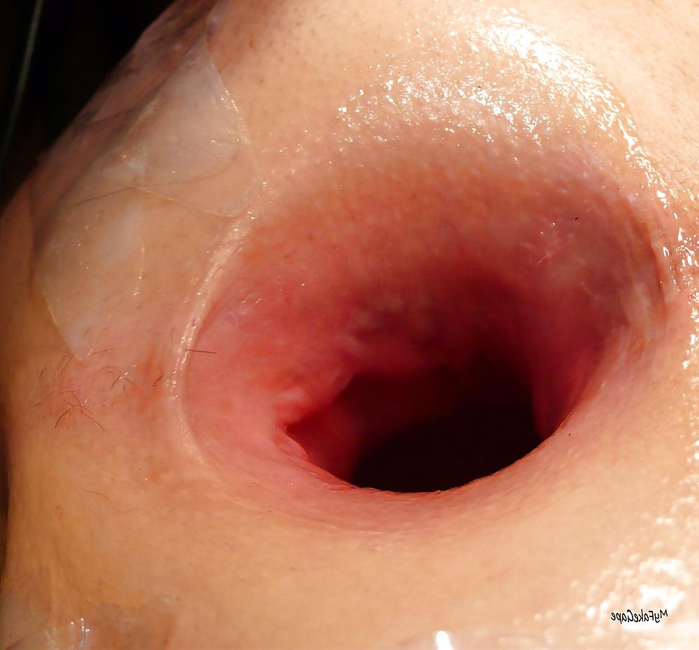 14P My FAKE GAPE 13