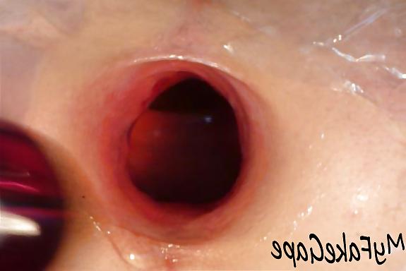 17P My Fake Gape 2