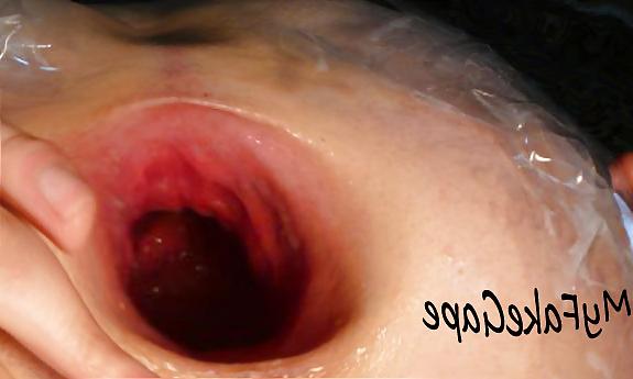 17P My Fake Gape 2