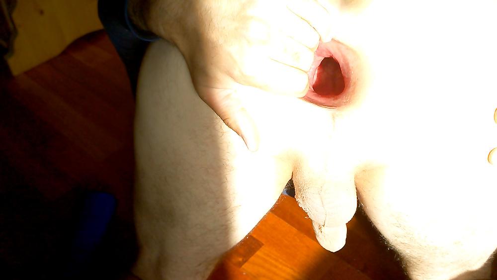 14P My wide open asshole gape in june 2015