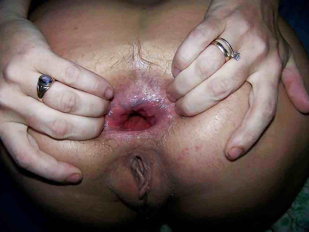 17P Dirty ass gape