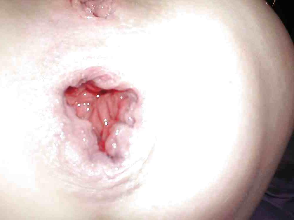 17P Dirty ass gape