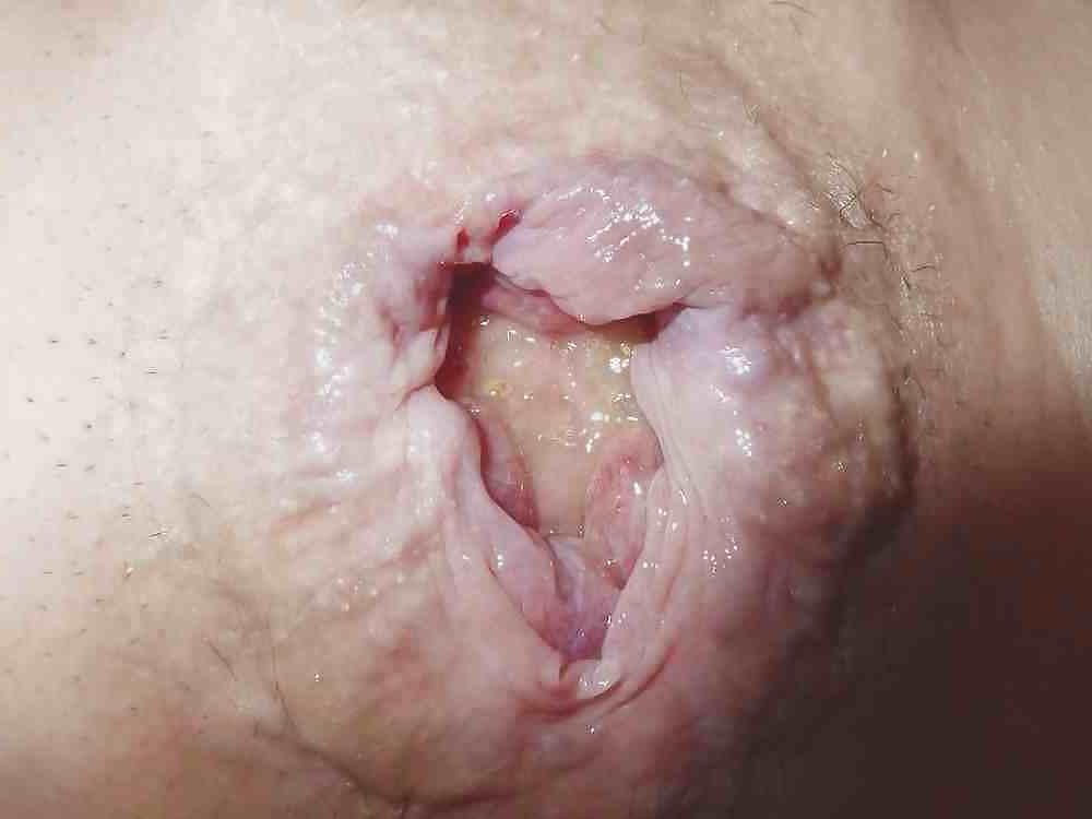 17P Dirty ass gape