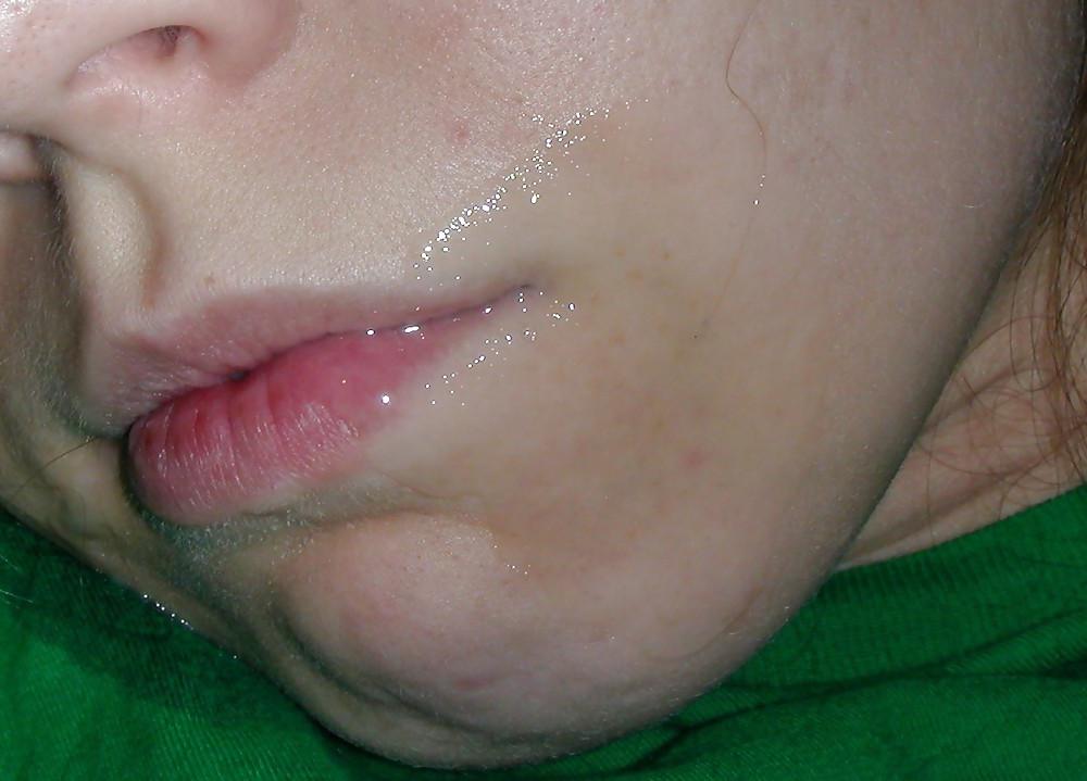 6P Slep facials 2