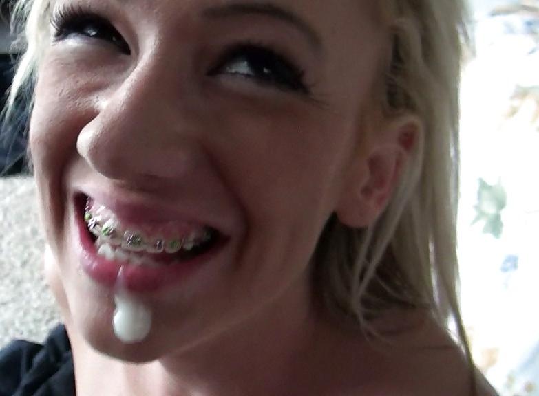 25P Cum on Braces