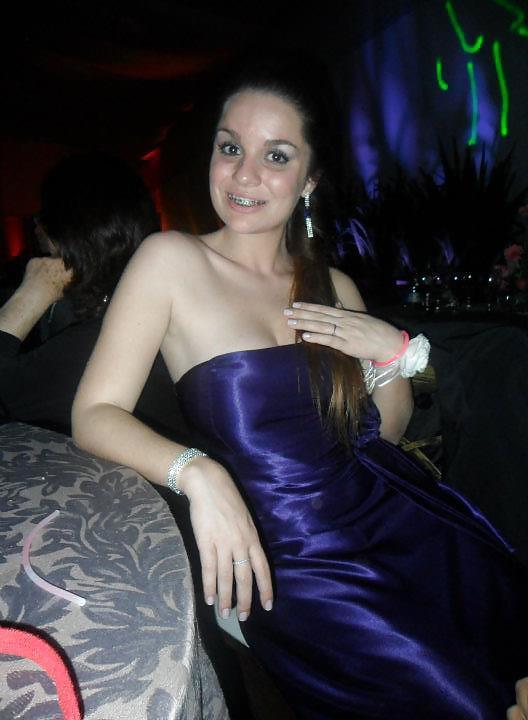 16P Aline, 20, want cum on her braces