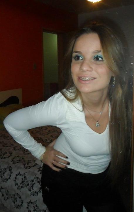 16P Aline, 20, want cum on her braces