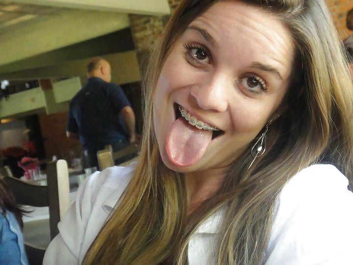 16P Aline, 20, want cum on her braces