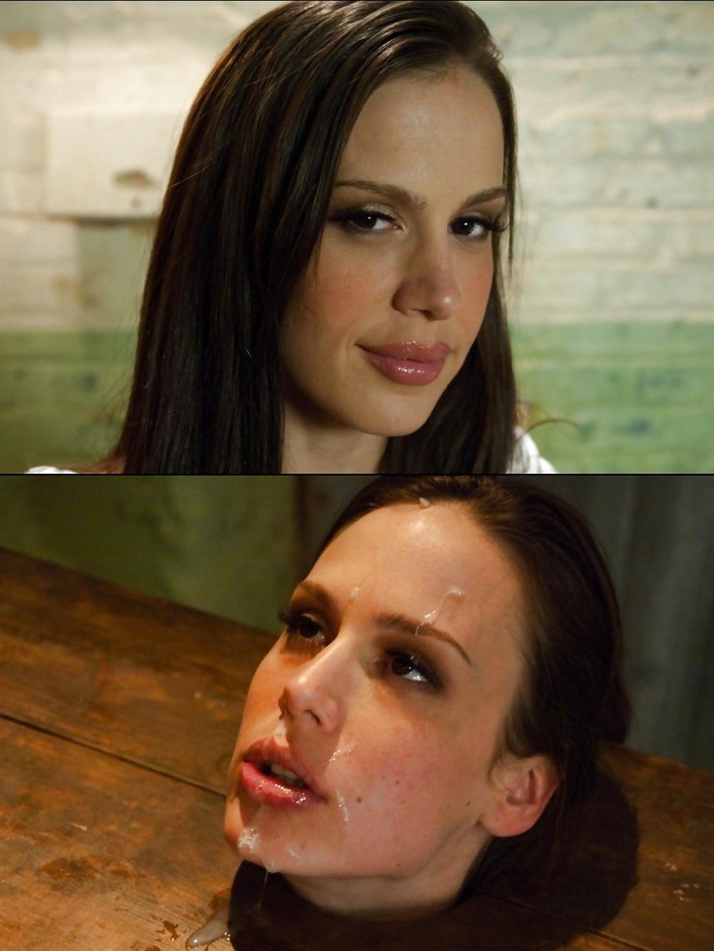 20P Before and After Facials 3
