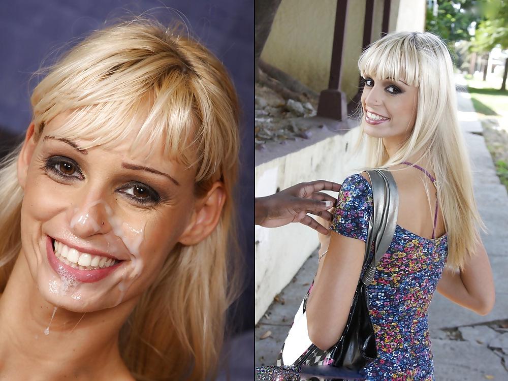 20P Before and After Facials 3