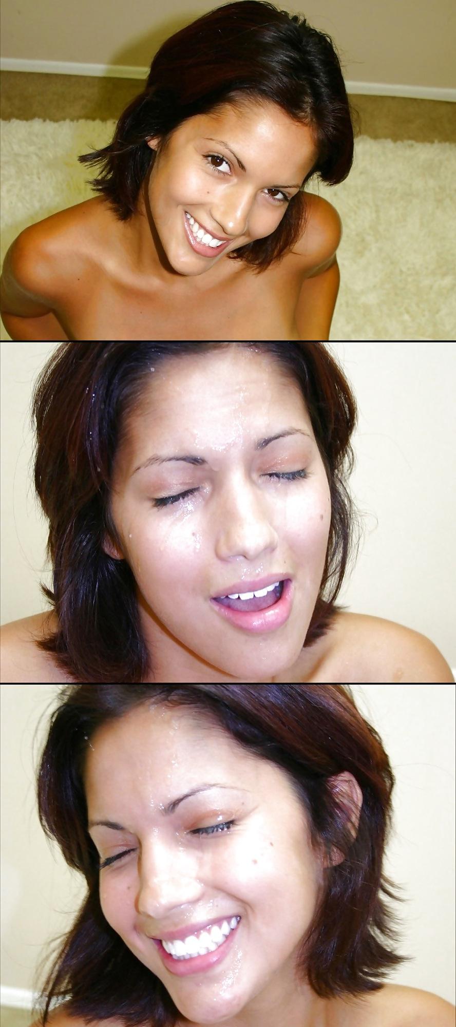 25P Before and After Facials 4